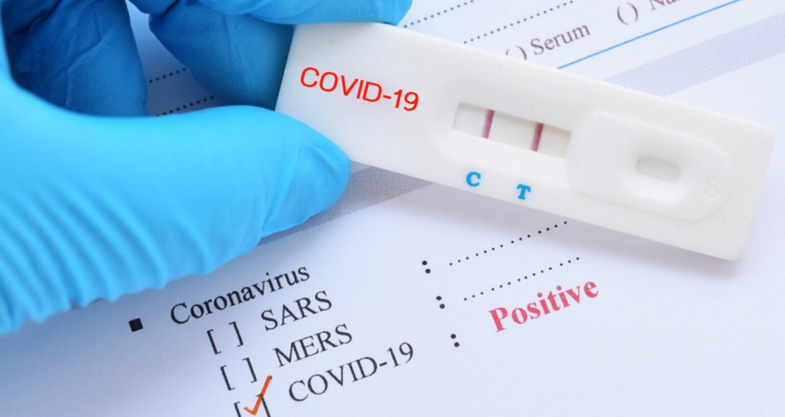 test-covid-1920x1020-c-default - Jurnalul Olteniei – Știri din Craiova și Oltenia