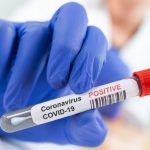 Incidența scade sub 5 la mie în Craiova