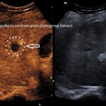 Foto: Facebook/ Spitalul Clinic Județean de Urgență Craiova