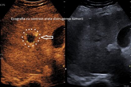Foto: Facebook/ Spitalul Clinic Județean de Urgență Craiova