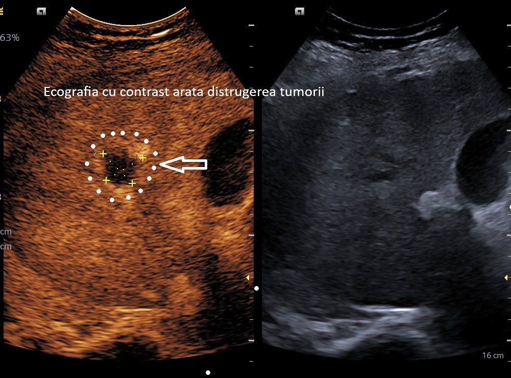 Foto: Facebook/ Spitalul Clinic Județean de Urgență Craiova - Jurnalul Olteniei – Știri din Craiova și Oltenia Foto: Facebook/ Spitalul Clinic Județean de Urgență Craiova