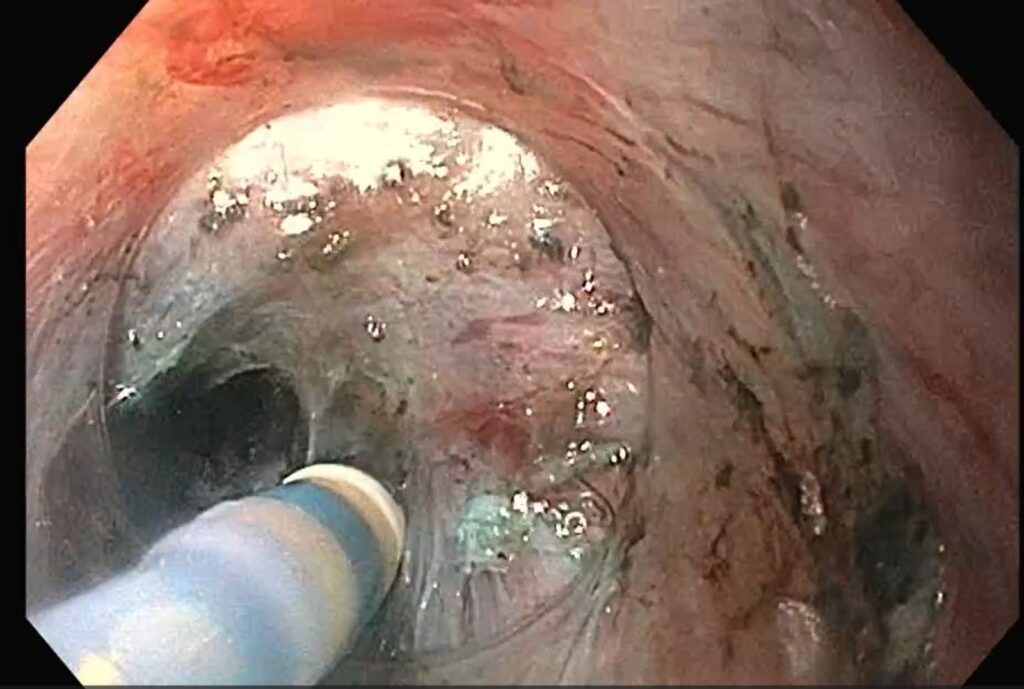 interventie POEM - Jurnalul Olteniei – Știri din Craiova și Oltenia