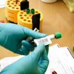 Ghid CNAS: Analize gratuite fără card de sănătate