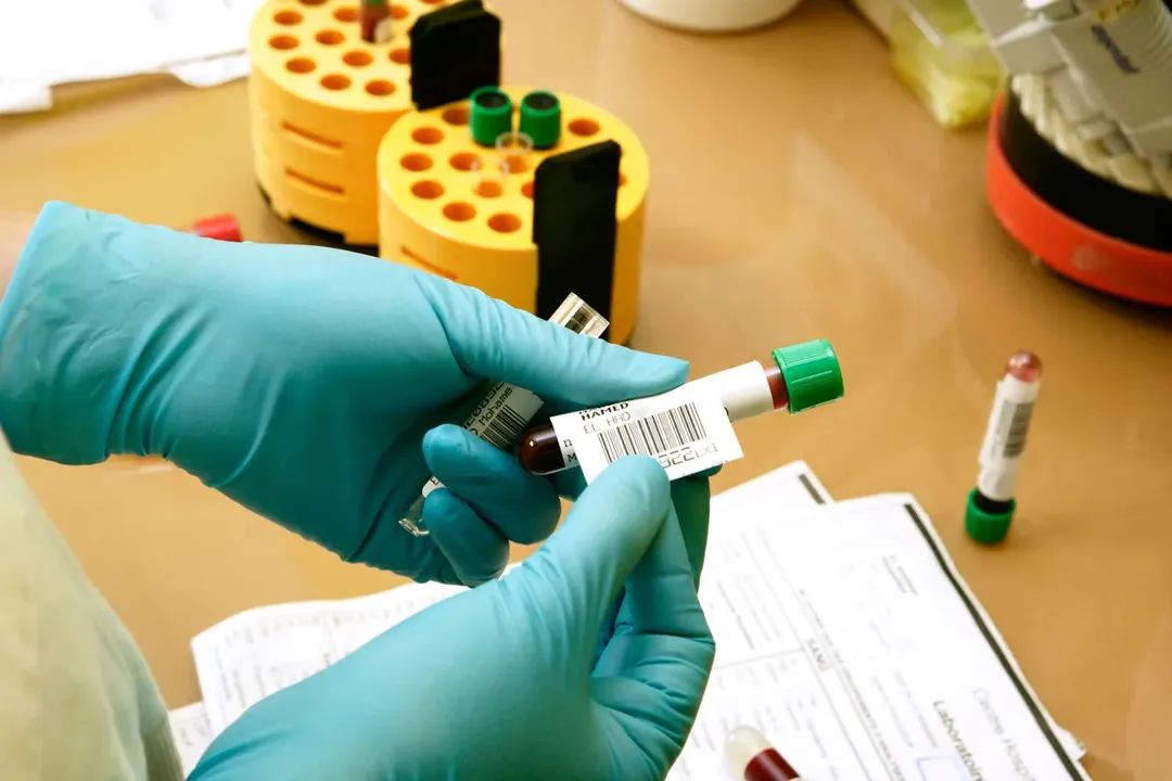 Ghid CNAS: Analize gratuite fără card de sănătate