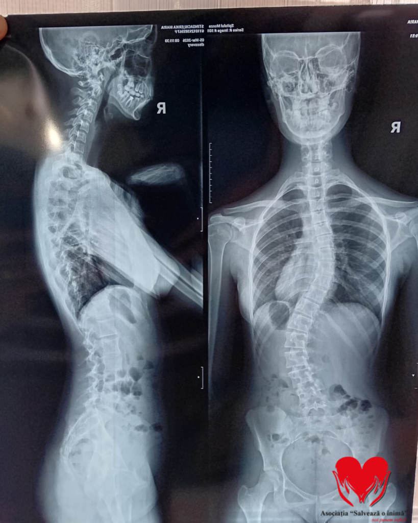 Apel pentru Erika: șansa ei la viață normală depinde de noi - Jurnalul Olteniei – Știri din Craiova și Oltenia Apel pentru Erika: șansa ei la viață normală depinde de noi