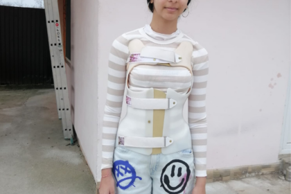 Apel pentru Erika: șansa ei la viață normală depinde de noi