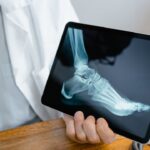 Doctor in a white coat holds a tablet showing a X-ray image of a foot/ankle in a clinical setting