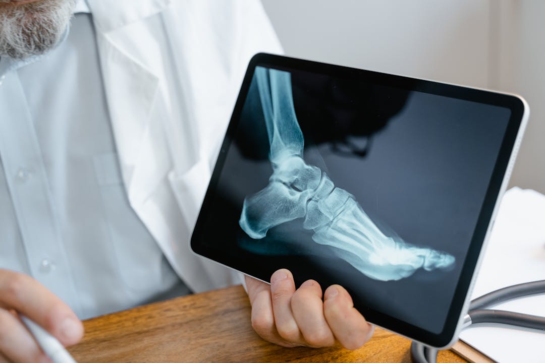 Doctor in a white coat holds a tablet showing a X-ray image of a foot/ankle in a clinical setting