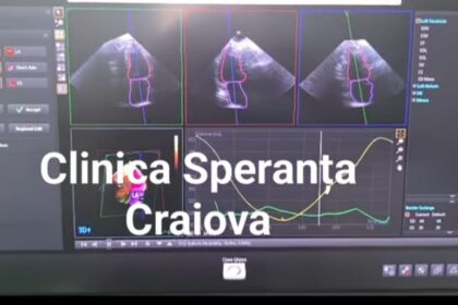 Clinica Speranța investește în tehnologie modernă – un nou ecograf a intrat în dotarea clinicii