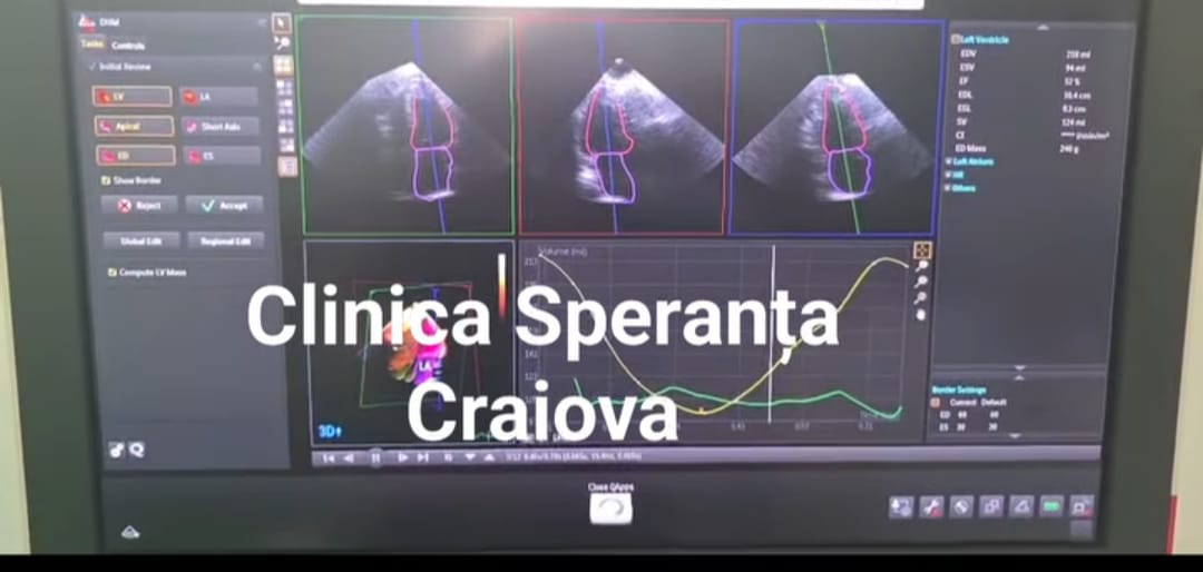 Clinica Speranța investește în tehnologie modernă – un nou ecograf a intrat în dotarea clinicii
