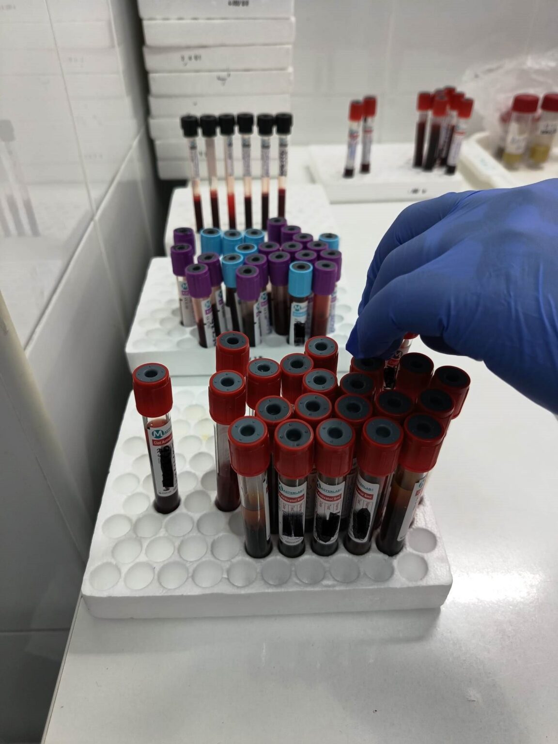 Gloved hand selecting a red-capped blood tube from a rack of specimen vials in a sterile lab.