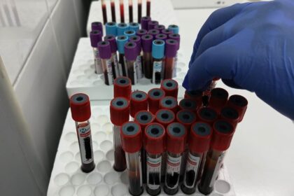 Gloved hand selecting a red-capped blood tube from a rack of specimen vials in a sterile lab.