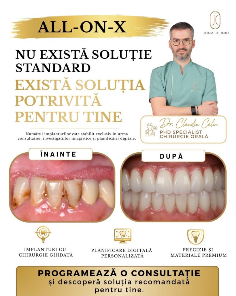 WhatsApp Image 2026-08-07 at 131514 3 - Jurnalul Olteniei – Știri din Craiova și Oltenia All-on-X dental implant ad with doctor on the right and before/after teeth images labeled ÎNAINTE and DUPĂ.