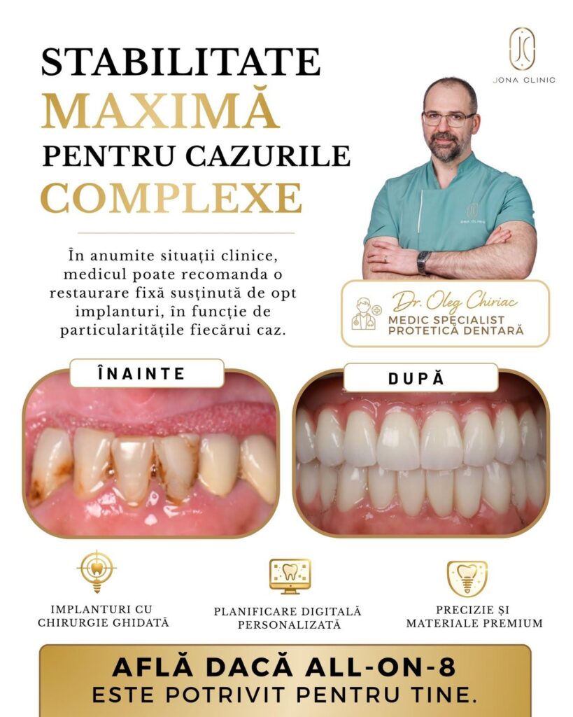 WhatsApp Image 2026-08-07 at 131514 4 - Jurnalul Olteniei – Știri din Craiova și Oltenia Poster promoting complex dental implants in Romanian: headline about maximum stability, doctor in teal scrubs, before-and-after teeth images labeled'ÎNAINTE' and 'DUPĂ', and icons for guided surgery, digital planning, and premium materials; call-to-action about All-on-8.